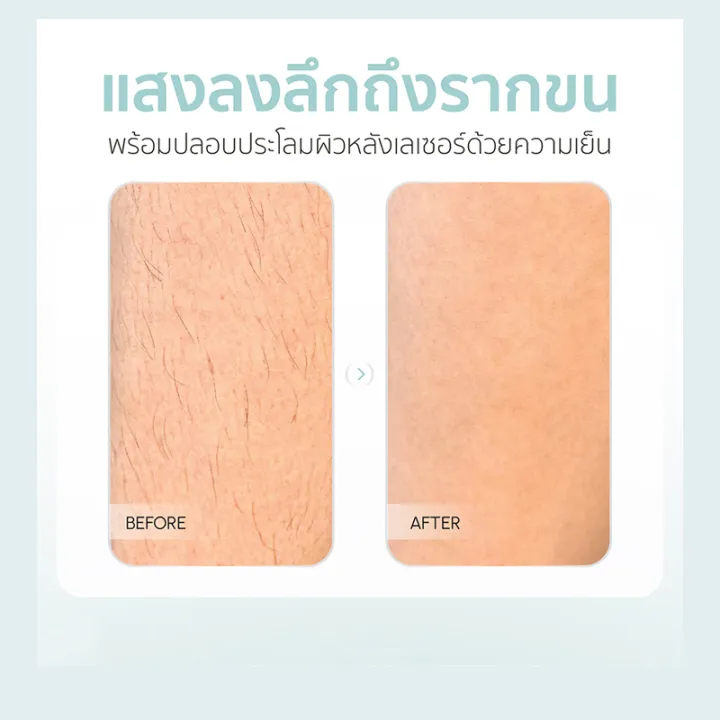 (Preorder)100%25%20Authentic%20Parin%20IPL%20Gen3%20Laser%20Removal%20Hair%20Removal%20Machine%20(999,999%20Shot)%20White%20Gold%20-%20Image%208