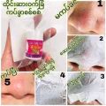 Blackhead, whitehead mask ဆားဝက်ခြံကပ်ခွာ. 