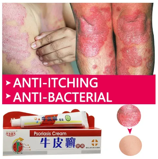 Psoriasis%20Dermatitis%20Eczematoid%20Eczema%20Cream%2025g%20%7C%20Natural%20Plant%20Extract%20%7C%20Anti%20Itch%20Chinese%20Herb%20Medical%20Skin%20Care%20Ointment%20-%20Image%205