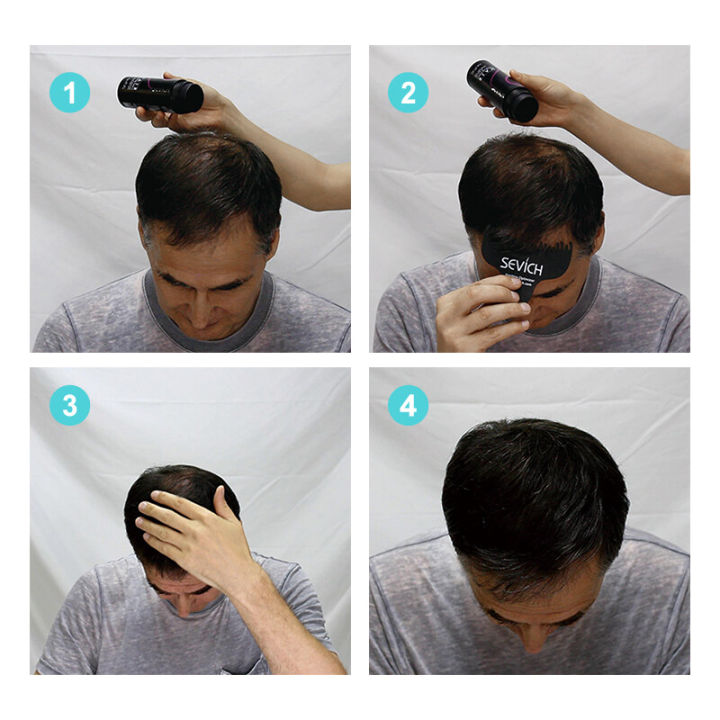 (Preorder)%20Sevich%202pcs%2025g%20bald%20hair%20closure%20fiber%20powder%20(black)%20hair%20building%20fiber%20dyeing%20-%20Image%203