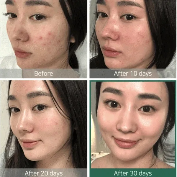 Simple%20Soothing%20Facial%20Toner%20200ML%20(MADE%20IN%20UK)%20(DIRECT%20IMPORT%20FROM%20UK)%20-%20Image%203