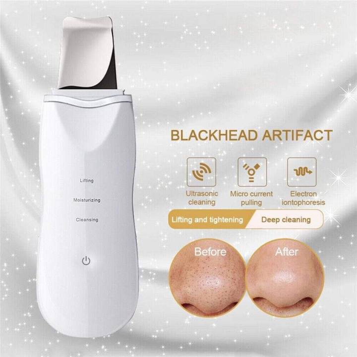 Beauty%20Start%20cosmetology%20shovel%20ultrasonic%20cleaner%20(without%20box)%20-%20Image%202