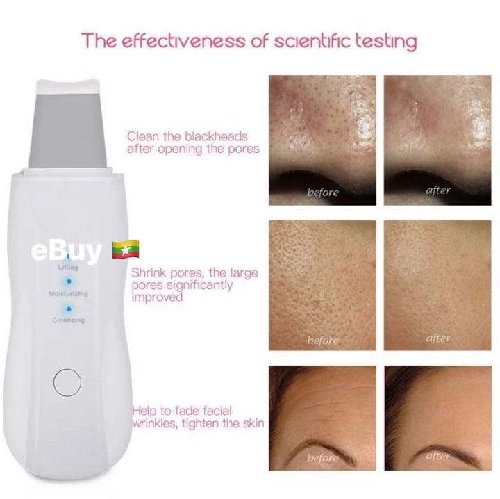 Beauty%20Start%20cosmetology%20shovel%20ultrasonic%20cleaner%20(without%20box)%20-%20Image%206