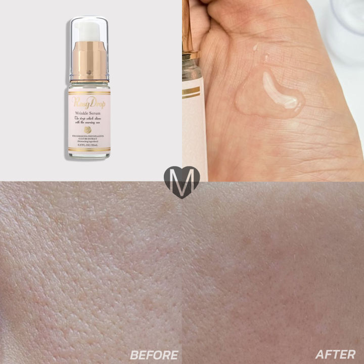 (Preorder)%20Rosy%20Drop%20Wrinkle%20Serum%2020ml%20Rose%20Balloon%20Serum%20Reduce%20wrinkles%20-%20Image%204
