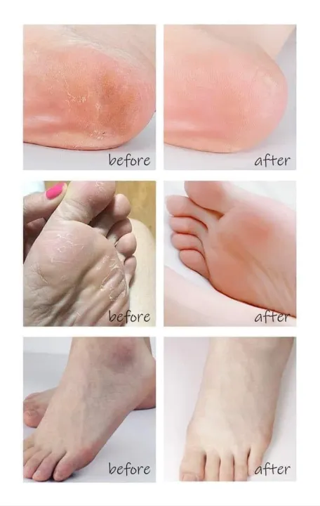 Vaseline%20Foot%20Cream%2050%20ml%20-%20Image%203