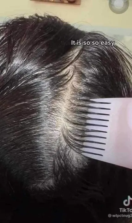 Hair%20Oil%20Scalp%20Comb%20With%20Bottle%20-%20Image%202