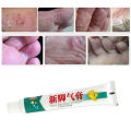 Relieve Itch Tinea Pedis Ointment 15g, Beriberi Cream, Athlete's Foot Toe Fungus Ringworm Itching Infection Paronychia Treatment. 