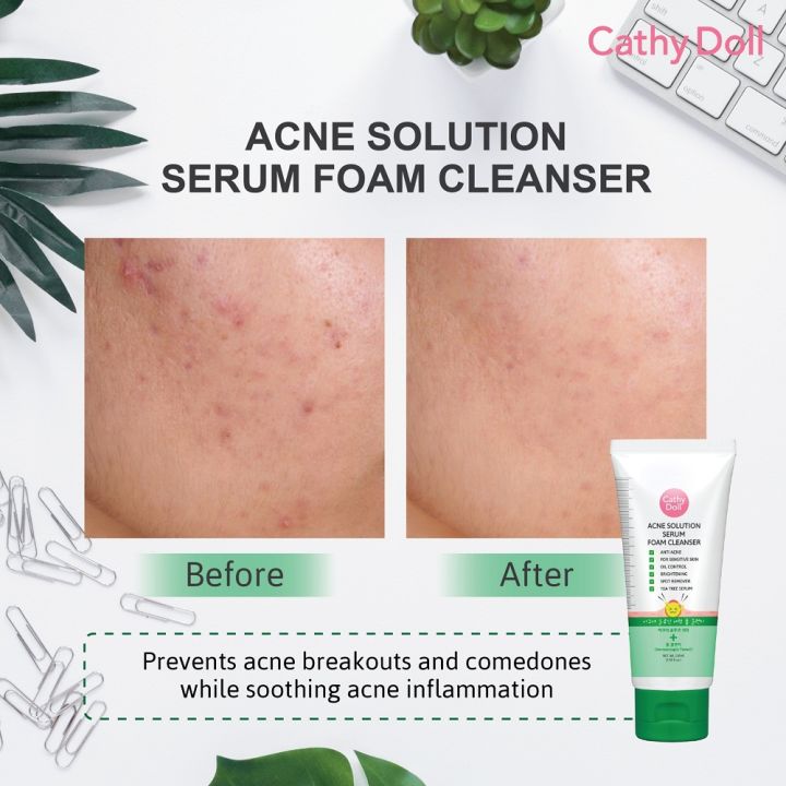 Cathy%20Doll%20Acne%20Solution%20Serum%20Foam%20Cleanser%20(100ml)%20-%20Image%203