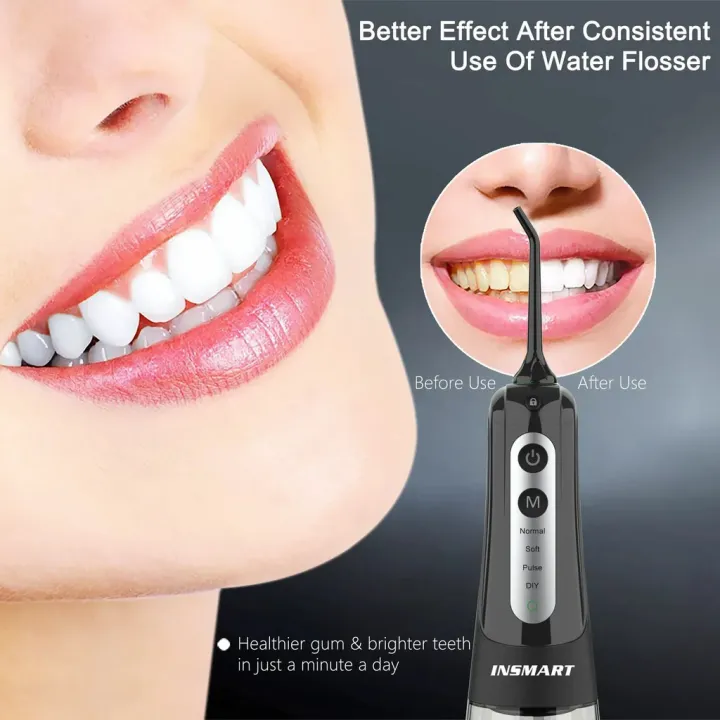 Cordless%20Water%20Dental%20Flosser%20Teeth%20Cleaner,%20INSMART%20Professional%20300ML%20Tank%20DIY%20Mode%20USB%20Rechargeable%20Dental%20Oral%20Irrigator%20for%20Home%20and%20Travel,%20IPX7%20Waterproof%206%20Modes%20Irrigate%20for%20Oral%20Care%20-%20Image%204