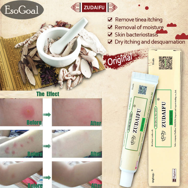 EsoGoal Natural Chinese Herbal  Cream Eczema Dermatitis Psoriasis Vitiligo Antibacterial Skin Disease Treatment ZUDAIFU, 1 Tube/Box(15g)