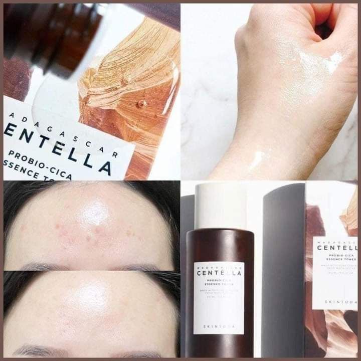 Skin1004%20Centella%20probio%20cica%20essence%20toner%20200ml%20made%20in%20Korea%20Fresh%20Date%20-%20Image%204