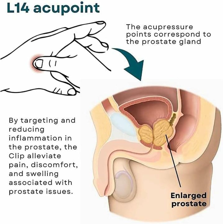 South%20Moon%20Prostate%20Care%20Point%20Clip,%20Prostate%20Care%20Point%20Clip,%20Acupressure%20Hand%20Pressure%20Point%20Clip,%20Relieve%20Prostate%20discomfort%20effortlessly,%20Migraine%20Relief%20Kidney%20Care%20-%20Image%205