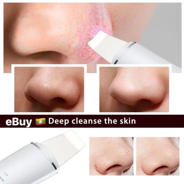 Beauty%20Start%20cosmetology%20shovel%20ultrasonic%20cleaner%20(without%20box)%20-%20Image%207