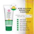Cathy Doll Acne Solution Serum Foam Cleanser (12ml). 