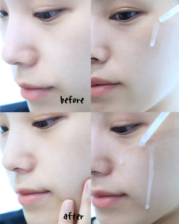 (Preorder)%20100%25%20authentic%20Coreana%20Ample:N%20Ceramide%20Shot%20Ampoule%2030mL%20strengthens%20the%20skin%20barrier%E2%97%8F%C2%A0If%C2%A0you%C2%A0want%C2%A0to%C2%A0know%C2%A0more%C2%A0details%C2%A0about%C2%A0the%C2%A0product,%C2%A0you%C2%A0can%C2%A0directly%C2%A0ask%C2%A0the%C2%A0seller%C2%A0through%C2%A0instant%C2%A0messages%C2%A0.%C2%A0%20-%20Image%203