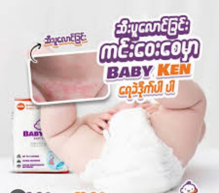 baby%20ken(%E1%80%9B%E1%80%B1%E1%80%81%E1%80%B2%E1%80%92%E1%80%AD%E1%80%AF%E1%80%80%E1%80%BA%E1%80%98%E1%80%AC)(S/M/L/XL/2XL%20size%20%E1%80%85%E1%80%AF%E1%80%B6%E1%80%9B%E1%80%9E%E1%80%8A%E1%80%BA)%20-%20Image%202