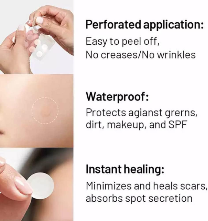 %F0%9F%A9%B9%20%E1%80%9D%E1%80%80%E1%80%BA%E1%80%81%E1%80%BC%E1%80%B6%E1%80%80%E1%80%95%E1%80%BA%E1%80%95%E1%80%9C%E1%80%AC%E1%80%85%E1%80%90%E1%80%AC%20%E1%80%A1%E1%80%80%E1%80%BC%E1%80%8A%E1%80%BA%20%F0%9F%AA%9E36%20pcs%20Mighty%20Patch%20clear%20circle%20Acne%20Pimple%20Patch%20%E2%9A%AA%20-%20Image%207