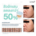 (Preorder) Dr.PONG ACNE ACE LONGWEAR CUSHION Acne reduction cushion, confirmed by research, skin does not clog. 