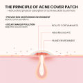 (Preorder)Sevich 200patches Star Shaped Acne Removal Pimple Patches Facial Care Stickers Skin Tag Remover Patch Star Acne Patch Acne Spot Treatment Ance Pimple Patches. 