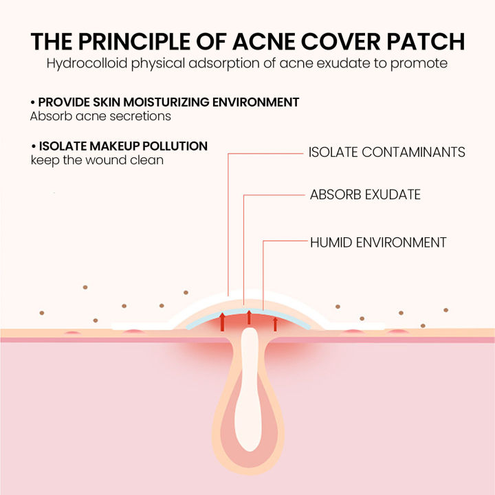 (Preorder)Sevich%20200patches%20Star%20Shaped%20Acne%20Removal%20Pimple%20Patches%20Facial%20Care%20Stickers%20Skin%20Tag%20Remover%20Patch%20Star%20Acne%20Patch%20Acne%20Spot%20Treatment%20Ance%20Pimple%20Patches%20-%20Image%207