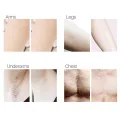 Pre Wax Smooth Body Hair Removal Spray 100% Natural Permanent  Hair Removal. 