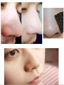 Nose Pore Blackhead Remover, Cleaning Strip Sticker, Peel Off Mask, 5 Pcs. 