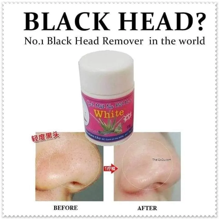White%20Gel%20%E1%80%86%E1%80%AC%E1%80%B8%E1%80%9D%E1%80%80%E1%80%BA%E1%80%81%E1%80%BC%E1%80%B6%E1%80%80%E1%80%95%E1%80%BA%E1%80%81%E1%80%BD%E1%80%AC%E1%80%98%E1%80%B0%E1%80%B8%20-%20Image%202