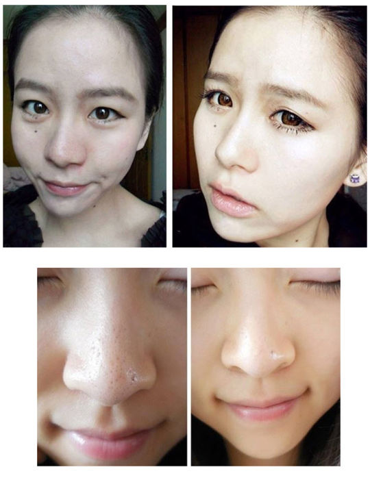 Nose%20Pore%20Blackhead%20Remover,%20Cleaning%20Strip%20Sticker,%20Peel%20Off%20Mask,%205%20Pcs%20-%20Image%208