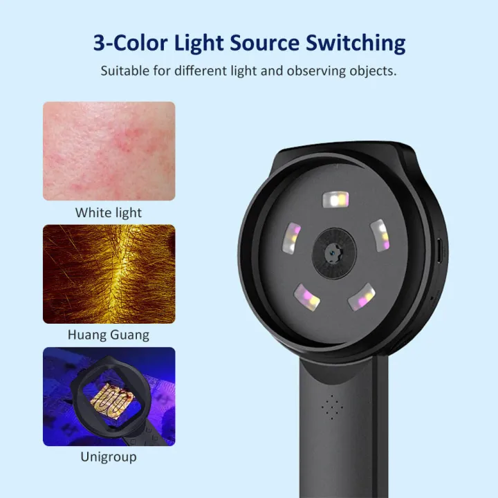 (Preorder)%20Handheld%20Skin%20Analyzer,%20Skin%20Analyzer%20Magnifier%20for%20Scalp/Skin/Follicle%20Testing%20Analysis,%2016MP%20UV%20Skin%20Analyzer%20-%20Image%207