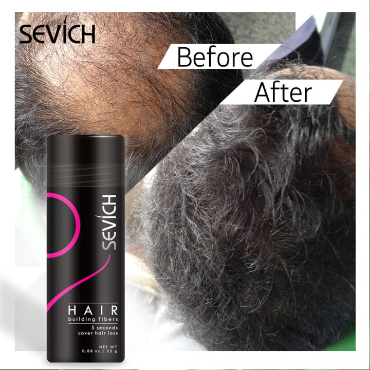 (Preorder)%20Sevich%202pcs%2025g%20bald%20hair%20closure%20fiber%20powder%20(black)%20hair%20building%20fiber%20dyeing%20-%20Image%206