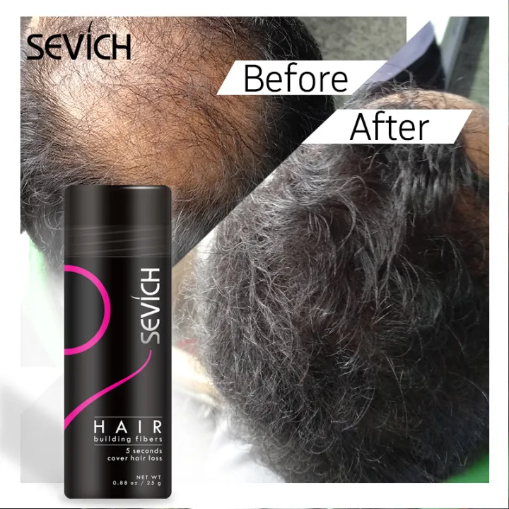 (Preorder)%20Sevich%202pcs%2025g%20bald%20hair%20closure%20fiber%20powder%20(black)%20hair%20building%20fiber%20dyeing%20-%20Image%206