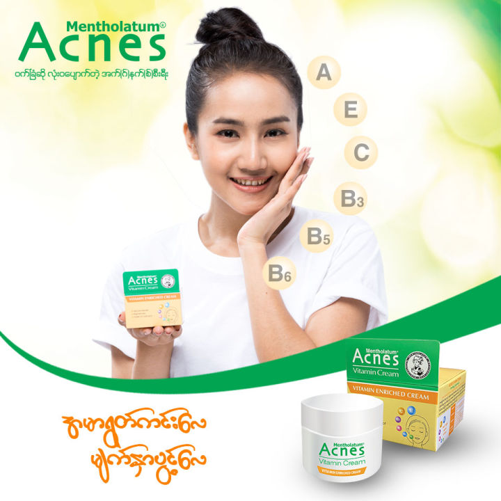 ACNES%20VITAMIN%20CREAM%2040G%20(Expire%20Date%2030-Oct-2026)%20-%20Image%202