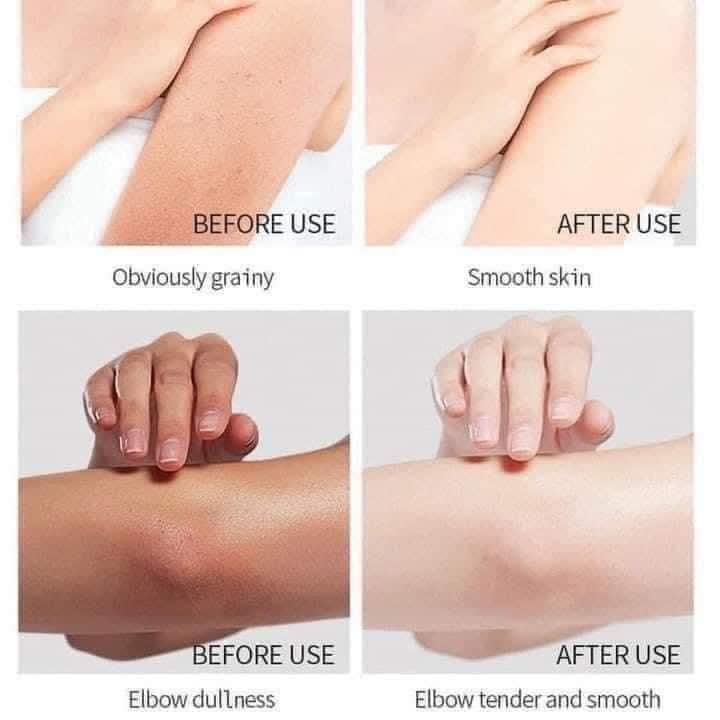 Dove%20Exfoliating%20Scrub%20-%20Image%204