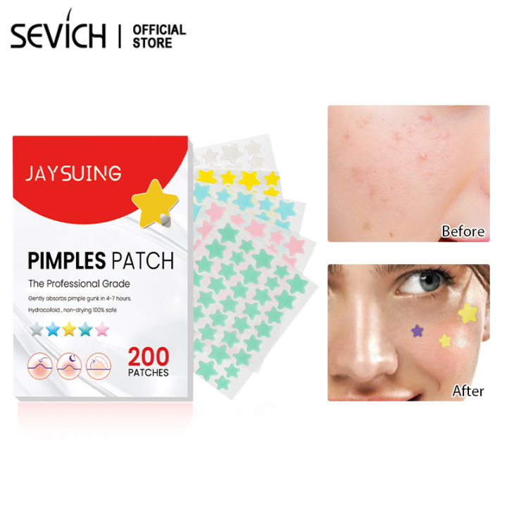 (Preorder)Sevich%20200patches%20Star%20Shaped%20Acne%20Removal%20Pimple%20Patches%20Facial%20Care%20Stickers%20Skin%20Tag%20Remover%20Patch%20Star%20Acne%20Patch%20Acne%20Spot%20Treatment%20Ance%20Pimple%20Patches%20-%20Image%203