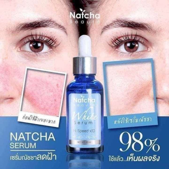 Natcha%20White%20Serum(30ml)%20-%20Image%203