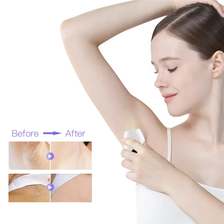CkeyiN%20Professional%20IPL%20Permanent%20Hair%20Removal%20Device%20with%208%20Levels%20for%20Body%20&%20Face%20600000%20Flashes%20IPL%20Laser%20Hair%20Removal%20System%20for%20Bikini%20Legs%20Underarm%20Arm%20Hair%20Removal%20MT099%20-%20Image%206
