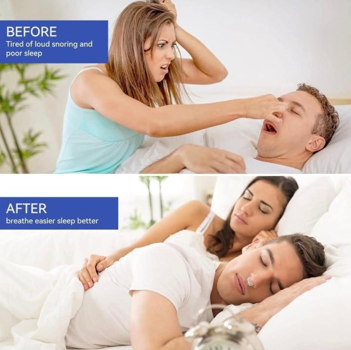 Anti%20Snoring%20Devices,%20Silicone%20Magnetic%20Anti%20Snoring%20Nose%20Clip,%20Snoring%20Solution%20Comfortable%20Nasal%20to%20Relieve%20Snore,%20Stop%20Snoring%20for%20Men%20and%20Women%20-%20Image%205
