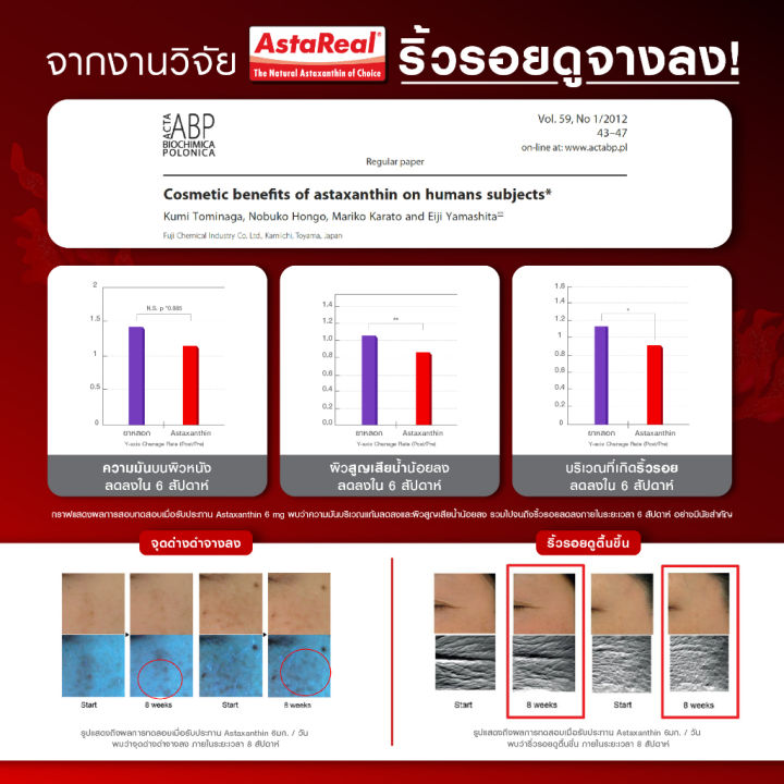 (Preorder)%20Bomi%20AstaReal%20Asta%20Concentrate%206%20(30%20Capsules)%20Astaxanthin%20tightens,%20smooth,%20soft,%20moisturized%20skin,%20reduces%20dark%20circles.%20-%20Image%205