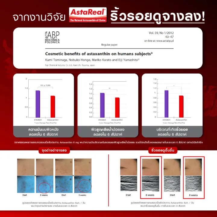 (Preorder)%20Bomi%20AstaReal%20Asta%20Concentrate%206%20(30%20Capsules)%20Astaxanthin%20tightens,%20smooth,%20soft,%20moisturized%20skin,%20reduces%20dark%20circles.%20-%20Image%205