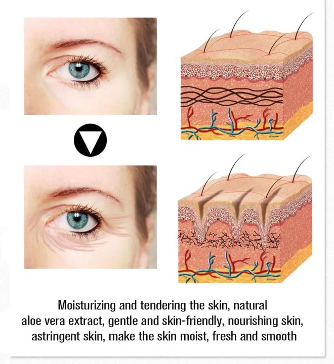Aloe%20Vera%20Eye%20Cream%2020g,%20Reduces%20Puffiness%20Dark%20Circles%20Fine%20Lines%20-%20Image%207