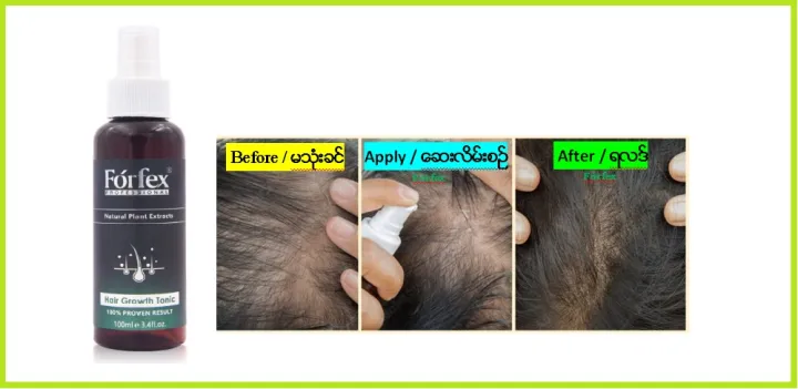 Hair%20Growth%20Tonic%20-%20Image%204