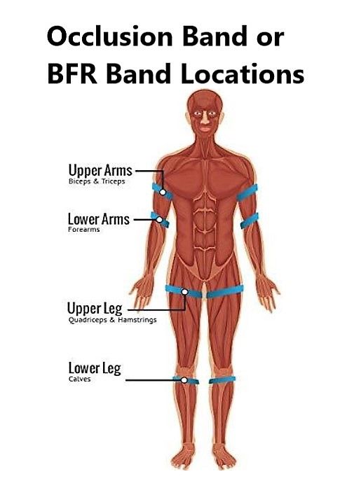 %5BFC%5D%201pair%20BFR%20Band%20(For%20Arm)%20-%20Image%202