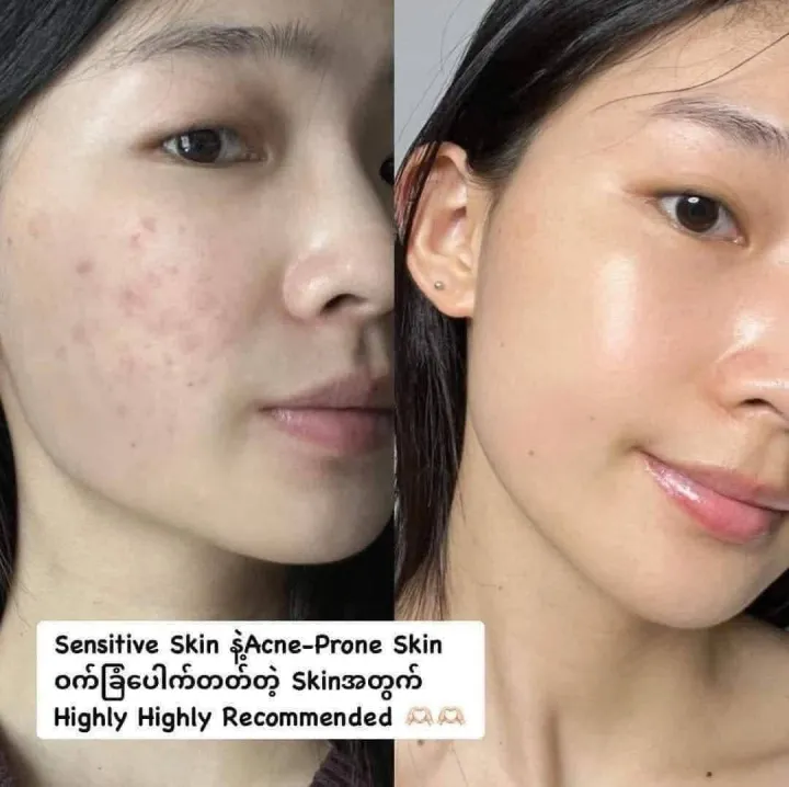 Skin%201004%20Madagascar%20Centella%20Travel%20Kit%20Set%20(5pcs%20per%20set%20kit)%20-%20Image%203