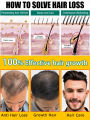 Hair growth essential oil, repair hair loss and baldness, restore thick hair. 