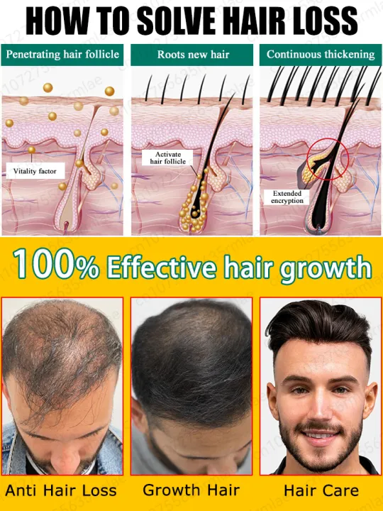Hair%20growth%20essential%20oil,%20repair%20hair%20loss%20and%20baldness,%20restore%20thick%20hair%20-%20Image%204