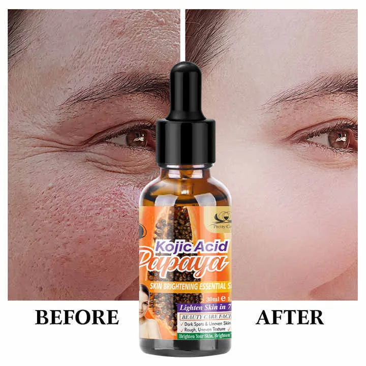 Kojic%20Acid%20Papaya%20Skin%20Brightening%20Essential%20Serum%20-%20Image%204