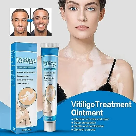 NUTRIG%20Vitiligo%20Treatment%20Cream%20for%20White%20Spots,%20Vitiligo%20Cream%20Treatment%20Ointment%20Leucoplia%20Relief%20Repair%20Melanin/20g%20-%20Image%202