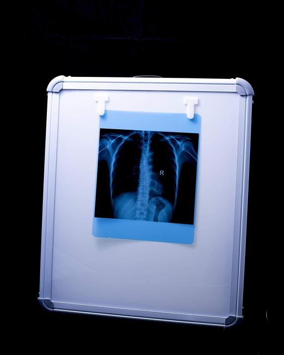 Led%20%20X-Ray%20View%20Box%20Single%20Film%20With%20Dimmer%20-%20Image%202