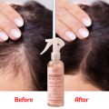 Girls Select Rosemary Water Spray – Boosts Hair Growth, Reduces Hair Breakage, and Provides Deep Hydration, Lightweight and Non-Greasy for Daily Use, with a Fresh Natural Fragrance. 