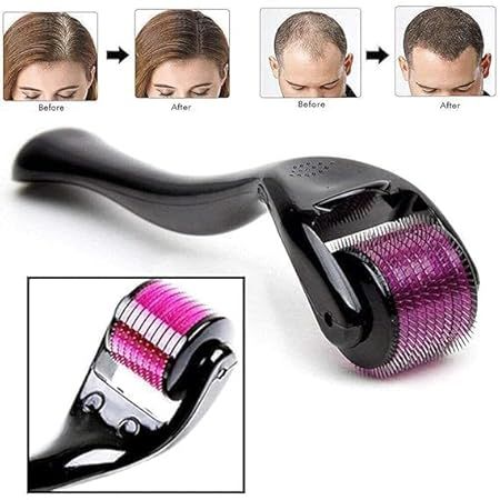 0.5mm%20Derma%20Roller%20540%20Micro%20Needle%20Therapy%20Skin%20For%20Hair%20Treatment%20and%20Face%20-%20Image%205